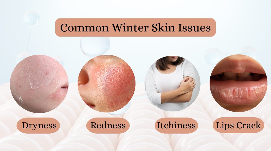 common winter skin issues